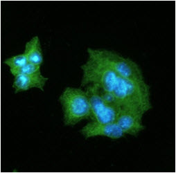 ICC/IF analysis of CRP in HepG2 cells line, stained with DAPI (Blue) for nucleus staining and monoclonal anti-human CRP antibody (1:100) with goat anti-mouse IgG-Alexa fluor 488 conjugate (Green).