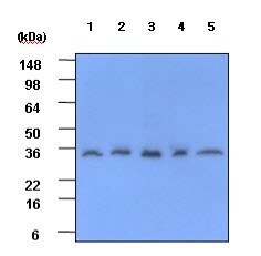 Cell lysates of NIH-3T3, HepG2, Jurkat, HeLa and SH-SY5Y (each 40ug) were resolved by SDS-PAGE, transferred to PVDF membrane and probed with anti-human CRP (1:1000). Proteins were visualized using a goat anti-mouse secondary antibody conjugated to HRP and an ECL detection system. 