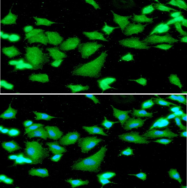 ICC/IF analysis of CSTB in U87MG cells line, stained with DAPI (Blue) for nucleus staining and monoclonal anti-human   CSTB antibody (1:100) with goat anti-mouse IgG-Alexa fluor 488 conjugate (Green).ICC/IF analysis of CSTB in A549 cells line, stained with DAPI (Blue) for nucleus staining and monoclonal anti-human   CSTB antibody (1:100) with goat anti-mouse IgG-Alexa fluor 488 conjugate (Green).