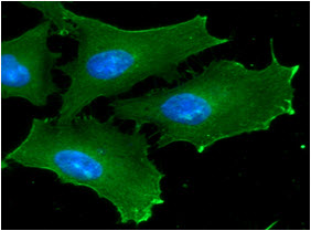 ICC/IF analysis of GSK3beta in HeLa cells line, stained with DAPI (Blue) for nucleus staining and monoclonal anti-human  GSK3beta antibody (1:100) with goat anti-mouse IgG-Alexa fluor 488 conjugate (Green).