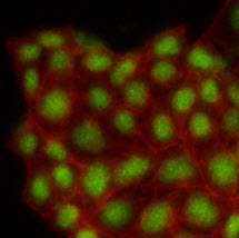 Immunofluorescence of human MCF7 cells stained with Phalloidin-TRITC (Red) for Actin staining and monoclonal anti-human MAPK1 antibody (1:500) with Alexa 488 (Green).