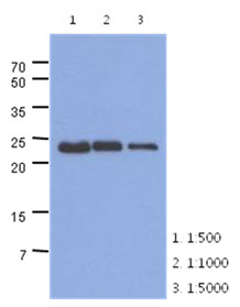 The extracts of mouse muscle (40ug) were resolved by SDS-PAGE, transferred to PVDF membrane and probed with anti-human TNNI1 antibody (1:500 ~ 1:5000). Proteins were visualized using a goat anti-mouse secondary antibody conjugated to HRP and an ECL detection system.