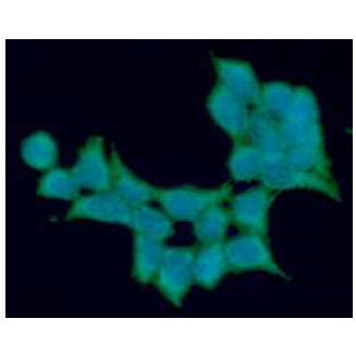 ICC/IF analysis of ALDH5A1 in 293T cells line, stained with DAPI (Blue) for nucleus staining and monoclonal anti-human ALDH5A1 antibody (1:100) with goat anti-mouse IgG-Alexa fluor 488 conjugate (Green).
